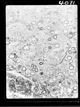 Fotomicrografia de blastomicose em pequeno roedor de laboratório