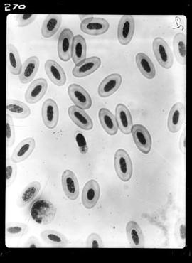 Fotomicrografia - Malária aviária (sangue de tucano com malária)