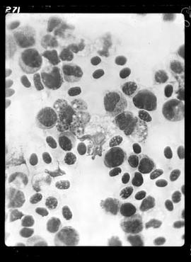 Fotomicrografia - Malária aviária (sangue de tucano com malária)