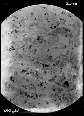 Fotomicrografia de bacilo de Hanseníase
