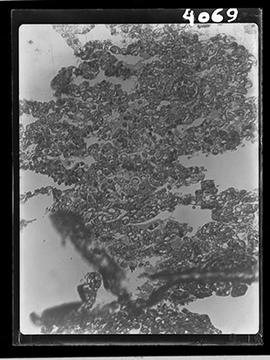 Fotomicrografia - Lâmina com Hanseníase (sequência 3 de 11)