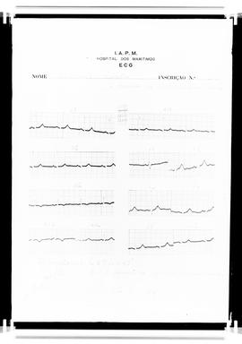Reprodução de registros gráficos impressos (eletrocardiograma) em folha do Hospital dos Marítimos