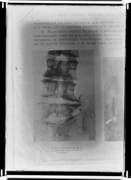 Reprodução de  radiografia (coluna) em publicação