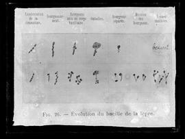 Reprodução de figura em publicação  com legenda: Evolução do bacilo da lepra (tradução)