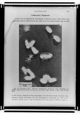 Reprodução de figura 75 Eletron micrografia de Rickettsia akari (Fotografia solicitada por Franci...