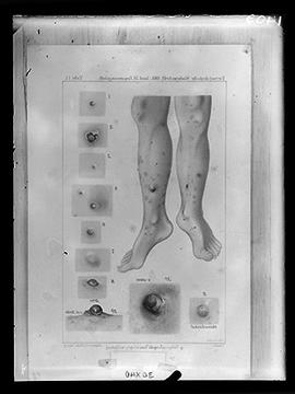 Reprodução de figuras (doença de Chagas) em publicação (Fotografia solicitada por Henrique da Roc...