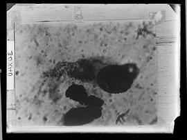 Reprodução de fotomicrografia de doença de Chagas (Fotografia solicitada por Henrique da Rocha Lima)