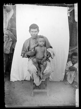 Homem sentado com criança hexadatilo (criança com 6 dedos). Tamanduá, PI.