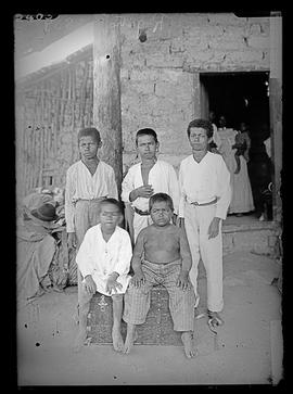 Meninos portadores de moléstia de Chagas [bócio]