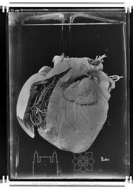 Peça anatômica - Coração com helmintos