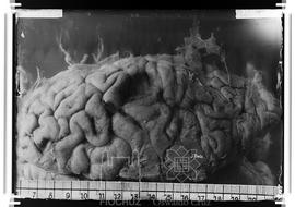 Peça anatômica - Cérebro