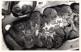 Detalhes do ciclo evolutivo do Trypanosoma cruzi na hemolinfa