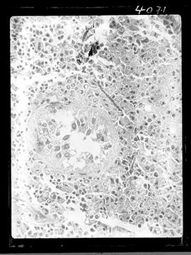 Fotomicrografia de blastomicose em pequeno roedor de laboratório