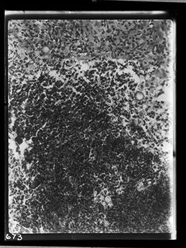 Fotomicrografia - Doença de Lôbo