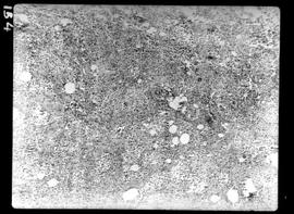 Fotomicrografia de Hanseníase experimental, pele, processo inflamatório com aumento de 70 vezes