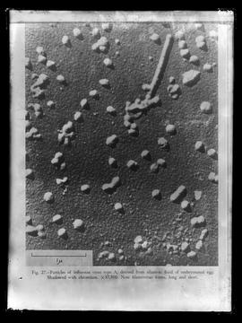 Reprodução da figura 27 (fotomicrografia) em publicação com a legenda: "Particles of Influen...