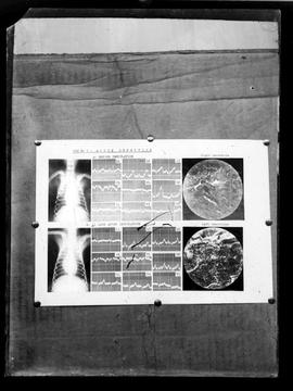 Reprodução de radiografia, gráfico e fotomicrografia em esquema