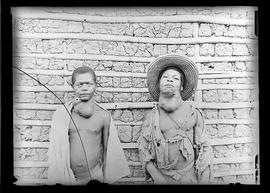 Dois jovens com moléstia de Chagas [bócio] [José Teixeira] Amaro Leite