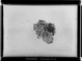 Peça anatômica - Pele biospsia (Fotografia solicitada por Antônio Eugênio de Arêa Leão)