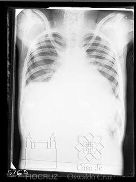 Reprodução de radiografia de tórax (Fotografia solicitada por Emmanuel Dias)