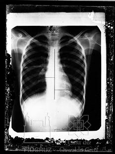 Reprodução de radiografia de tórax