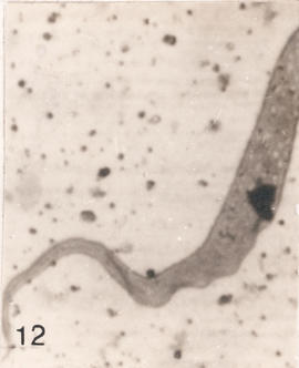 Epimastigotas observados em Triatoma sordida