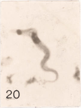 Metacíclicos observados em Panstrongylus megistus
