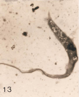 Epimastigotas observados em Triatoma pseudomaculata