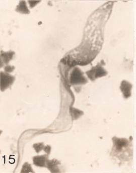 Epimastigotas observados em Triatoma rubrovaria